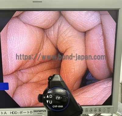 Cystoscope&nbsp;|&nbsp;OLYMPUS&nbsp;|&nbsp;CYF-VHA