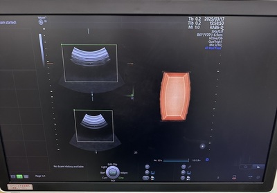 4D Ultrasound&nbsp;|&nbsp;GE&nbsp;|&nbsp;Voluson E8 BT18