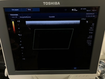 Color Doppler&nbsp;|&nbsp;CANON&nbsp;|&nbsp;Aplio 300