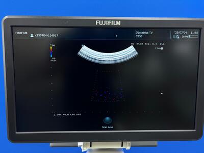 Ultrasound System&nbsp;|&nbsp;FUJIFILM&nbsp;|&nbsp;ARIETTA 50