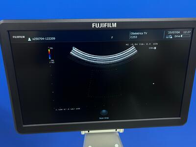 超音波診断装置&nbsp;|&nbsp;富士フィルムヘルスケア株式会社&nbsp;|&nbsp;ARIETTA 50の写真