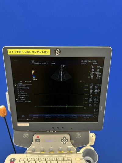 Color Doppler&nbsp;|&nbsp;GE&nbsp;|&nbsp;LOGIQ P6