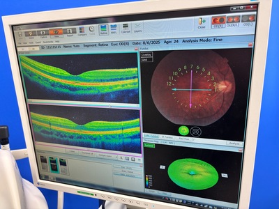 OCT with Non-mydriatic retinal camera&nbsp;|&nbsp;TOPCON&nbsp;|&nbsp;3D OCT 1 / Maestro 1