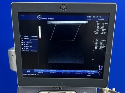 Color Doppler&nbsp;|&nbsp;GE&nbsp;|&nbsp;LOGIQ P6