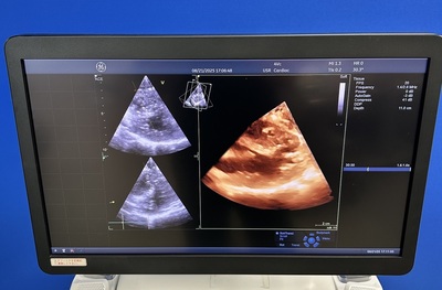 Color Doppler&nbsp;|&nbsp;GE&nbsp;|&nbsp;Vivid E95 Urtla Edition