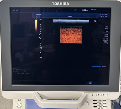 Color Doppler&nbsp;|&nbsp;CANON&nbsp;|&nbsp;Aplio 300