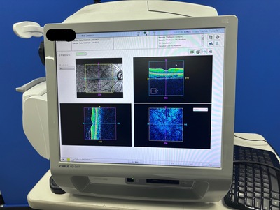 Zeiss OCT&nbsp;|&nbsp;Carl Zeiss&nbsp;|&nbsp;Cirrus 500 HD-OCT Plus