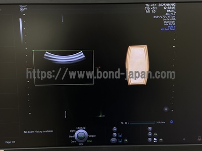 4D Ultrasound&nbsp;|&nbsp;GE&nbsp;|&nbsp;Voluson E10 BT18