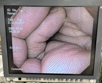 Video Gastroscope&nbsp;|&nbsp;OLYMPUS&nbsp;|&nbsp;GIF-Q150X