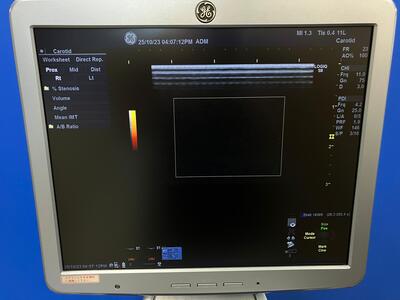 Color Doppler&nbsp;|&nbsp;GE&nbsp;|&nbsp;LOGIQ S8