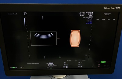 4D Ultrasound&nbsp;|&nbsp;GE&nbsp;|&nbsp;Voluson E10 BT21