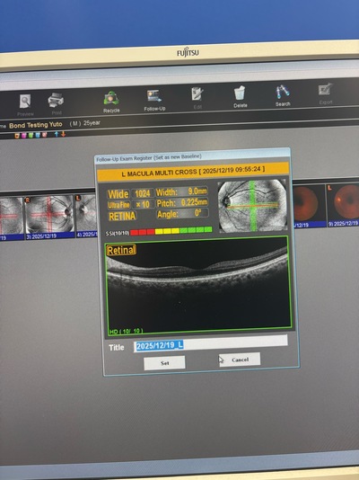A Combination system of OCT and fundus camera&nbsp;|&nbsp;NIDEK&nbsp;|&nbsp;RS-330 Retina Scan Duo