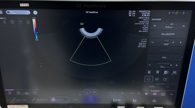 Ultrasound System&nbsp;|&nbsp;GE&nbsp;|&nbsp;Voluson Swift BT23