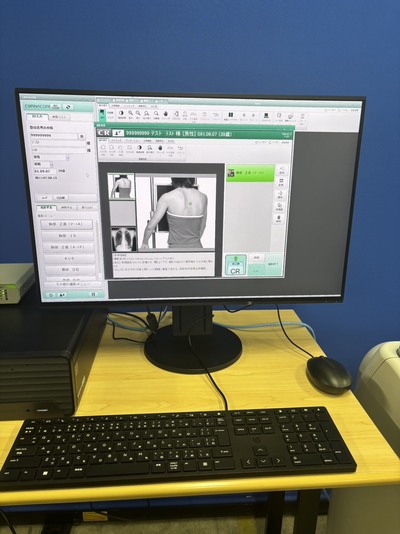 CRシステム&nbsp;|&nbsp;富士フイルムメディカル株式会社&nbsp;|&nbsp;FCR PRIMAの写真