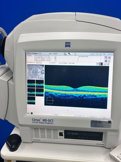 High-demended OCT&nbsp;|&nbsp;Carl Zeiss&nbsp;|&nbsp;Cirrus 4000 HD OCT