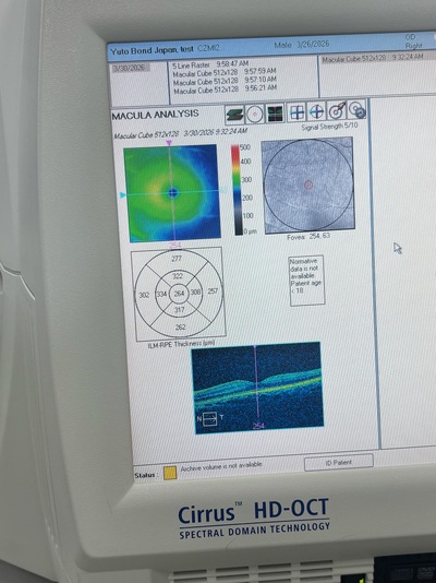 USED conditioned OCT&nbsp;|&nbsp;Carl Zeiss&nbsp;|&nbsp;Cirrus 4000 HD OCT