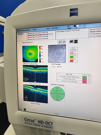 Windows 10 PRO Zeiss OCT&nbsp;|&nbsp;Carl Zeiss&nbsp;|&nbsp;Cirrus 4000 HD OCT