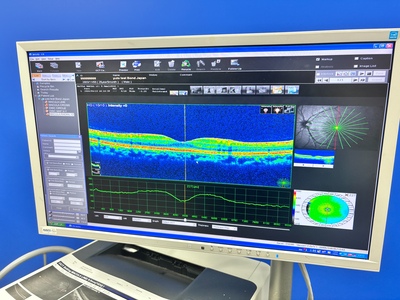 OCT with Fundus function&nbsp;|&nbsp;NIDEK&nbsp;|&nbsp;RS-3000