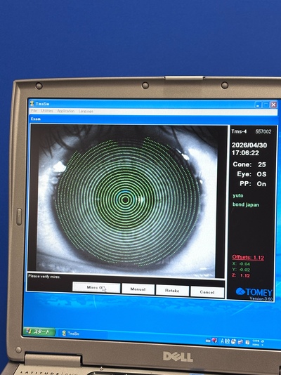 Corneal Topographer System&nbsp;|&nbsp;TOMEY&nbsp;|&nbsp;TMS-4
