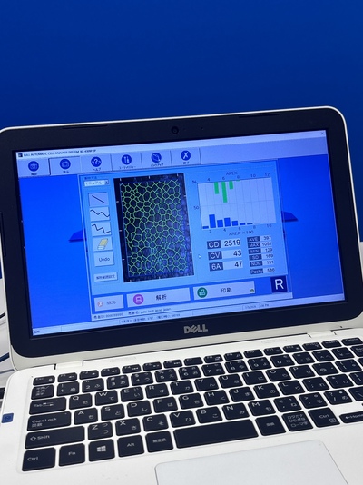 Specular Microscope&nbsp;|&nbsp;KONAN MEDICAL&nbsp;|&nbsp;NonconROBOⅡ- NSP-9900 Ⅱ