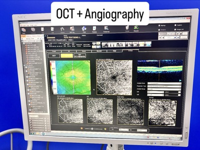 Fully Refurbished OCT with Angiography + Anterior Lens kit&nbsp;|&nbsp;NIDEK&nbsp;|&nbsp;RS-3000 Advance