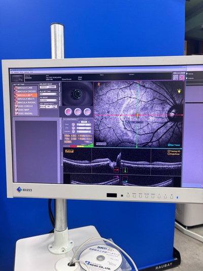 ANGIOGRAPHY Installed. No injections required. An unprecedented, high-definition 3D map of retinal blood flow drawn with light.&nbsp;|&nbsp;NIDEK&nbsp;|&nbsp;RS-3000 Advance