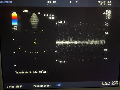 Ultrasound System&nbsp;|&nbsp;HITACHI&nbsp;|&nbsp;Prosound α7
