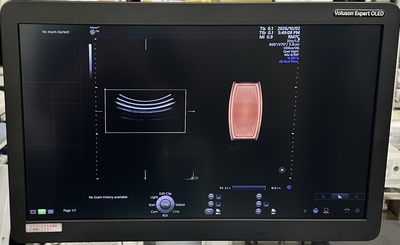 4D Ultrasound&nbsp;|&nbsp;GE&nbsp;|&nbsp;Voluson E10 BT21