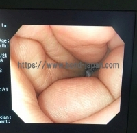 大腸スコープ&nbsp;|&nbsp;オリンパス&nbsp;|&nbsp;PCF-Q260AZIの写真