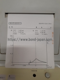 インピーダンスオージオメータ&nbsp;|&nbsp;リオン株式会社&nbsp;|&nbsp;RS-33の写真