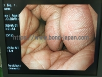 Video Gastroscope&nbsp;|&nbsp;OLYMPUS&nbsp;|&nbsp;GIF-H260