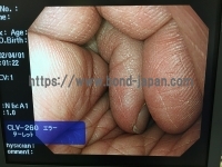 Video Gastroscope&nbsp;|&nbsp;OLYMPUS&nbsp;|&nbsp;GIF-H260