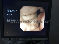 Video Colonoscope&nbsp;|&nbsp;OLYMPUS&nbsp;|&nbsp;CF-200I
