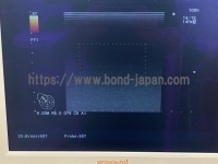 Color Doppler&nbsp;|&nbsp;ALOKA&nbsp;|&nbsp;Prosound Alpha 10