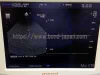 Color Doppler&nbsp;|&nbsp;HITACHI&nbsp;|&nbsp;Prosound α6