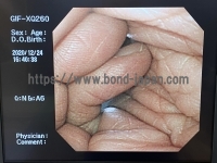 Video Gastroscope&nbsp;|&nbsp;OLYMPUS&nbsp;|&nbsp;GIF-XQ260