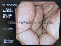 Video Gastroscope&nbsp;|&nbsp;OLYMPUS&nbsp;|&nbsp;GIF-XP260NS