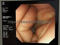 上部消化管ビデオスコープ&nbsp;|&nbsp;オリンパス&nbsp;|&nbsp;GIF-XP290Nの写真