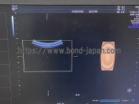 4D Ultrasound&nbsp;|&nbsp;GE&nbsp;|&nbsp;Voluson E10