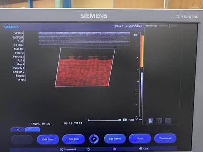 Color Doppler&nbsp;|&nbsp;SIEMENS&nbsp;|&nbsp;X300 PE