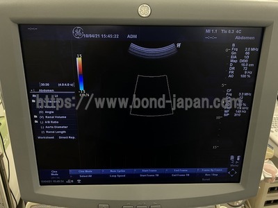 Color Doppler&nbsp;|&nbsp;GE&nbsp;|&nbsp;LOGIQ P5