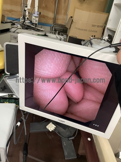 電子内視鏡セット&nbsp;|&nbsp;株式会社町田製作所&nbsp;|&nbsp;ENT-30VE/VSP-2000の写真