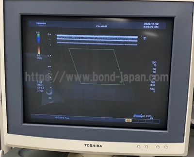 Color Doppler&nbsp;|&nbsp;CANON&nbsp;|&nbsp;SSA-660A Xario