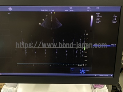 超音波診断装置（循環器向け）&nbsp;|&nbsp;GEヘルスケア・ジャパン株式会社&nbsp;|&nbsp;Vivid E95 Urtla Editionの写真