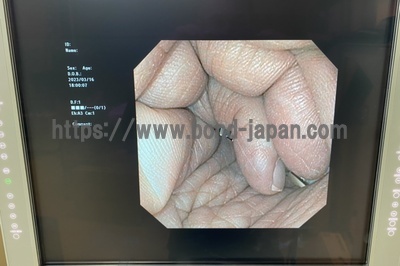 Video Gastroscope&nbsp;|&nbsp;OLYMPUS&nbsp;|&nbsp;GIF-XP170N