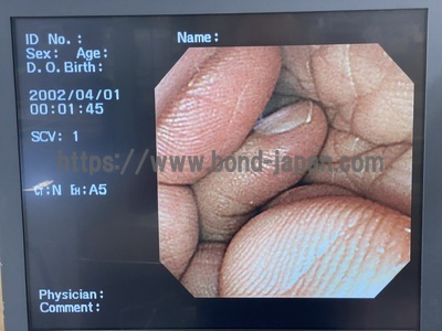 Video Gastroscope&nbsp;|&nbsp;OLYMPUS&nbsp;|&nbsp;GIF-XP260NS