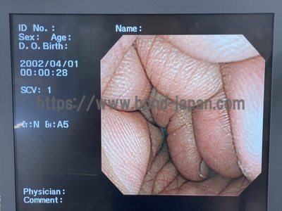 Video Gastroscope&nbsp;|&nbsp;OLYMPUS&nbsp;|&nbsp;GIF-XP260N