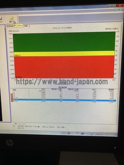 X-ray Bone Densitometer&nbsp;|&nbsp;GE&nbsp;|&nbsp;Prodigy