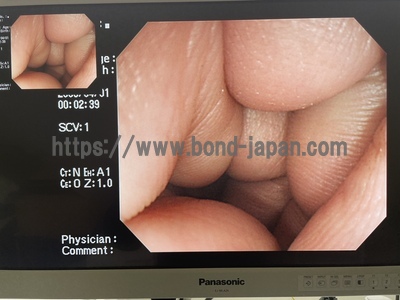 Video Colonoscope&nbsp;|&nbsp;OLYMPUS&nbsp;|&nbsp;PCF-Q260AI