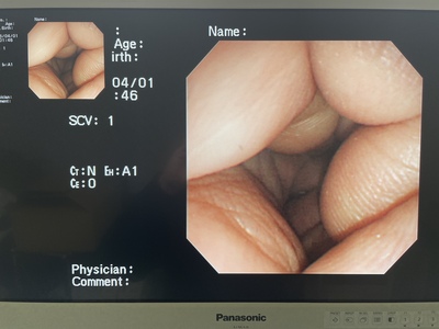 Video Gastroscope&nbsp;|&nbsp;OLYMPUS&nbsp;|&nbsp;GIF-N260